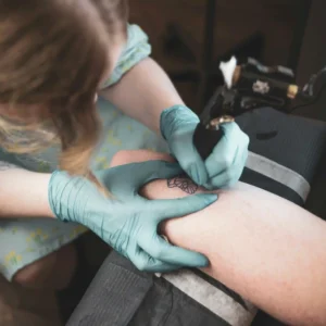 saline solution tattoo removal